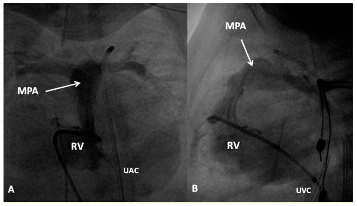 Figure 16