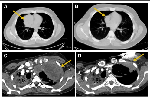 Fig 4.