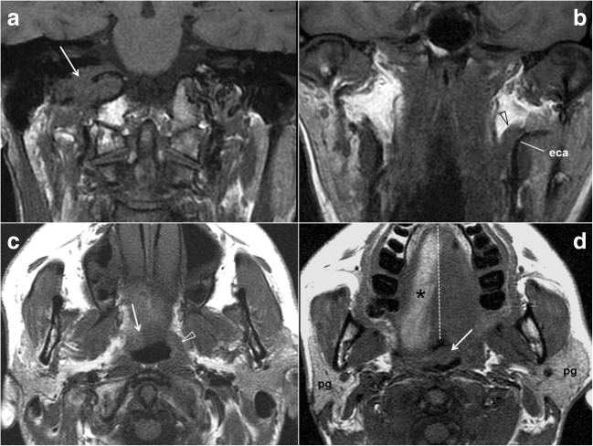 Fig. 12