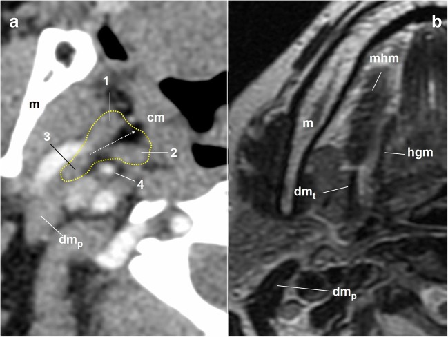 Fig. 10