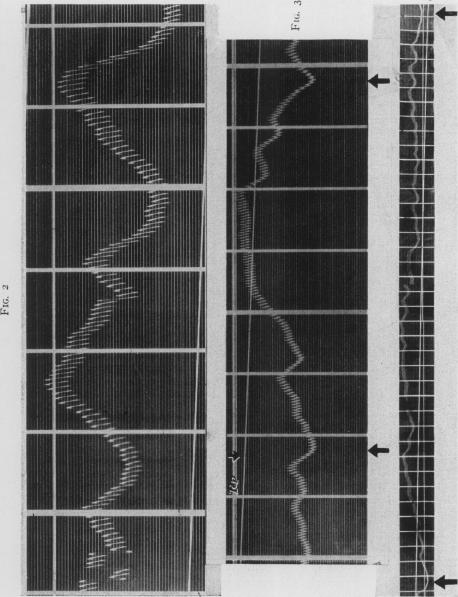 Fig. 2., Fig. 3., Fig. 4.