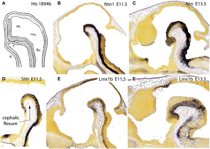 Figure 11