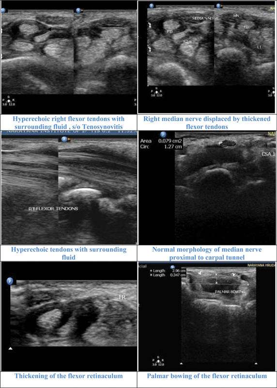 Fig. 16