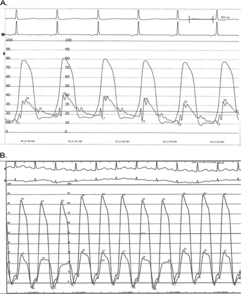 FIGURE 4.