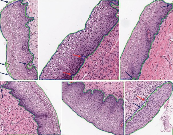 Figure 11