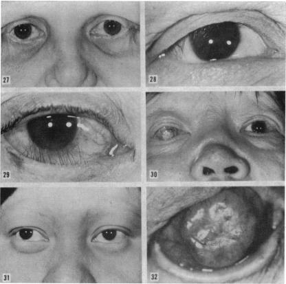 FIGURE 27, 28, 29, 30, 31, 32