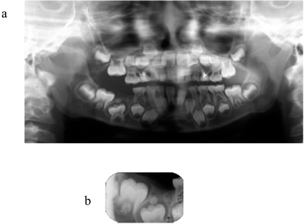 Fig. (1)