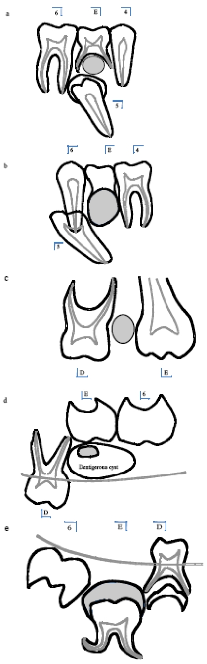 Fig. (2)