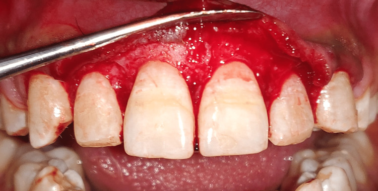 Figure 10