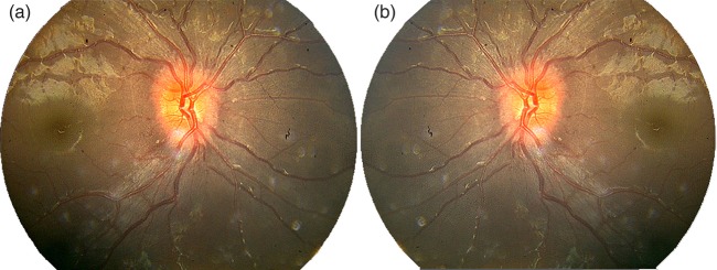 Figure 2