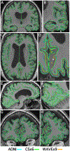 Fig. 3.