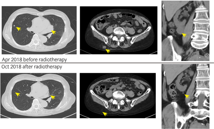 Fig. 3