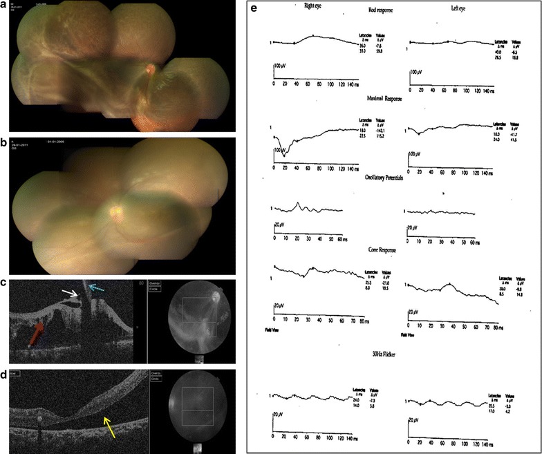 Fig. 1