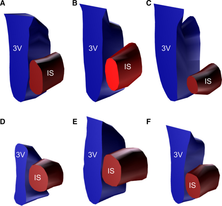 FIGURE 2