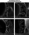 Fig. 14