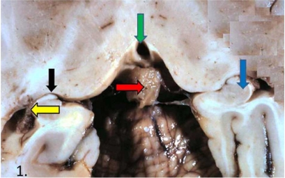 Fig. (1)