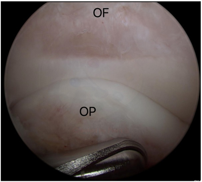 Fig. 7