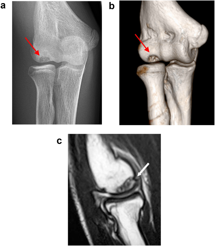 Fig. 2