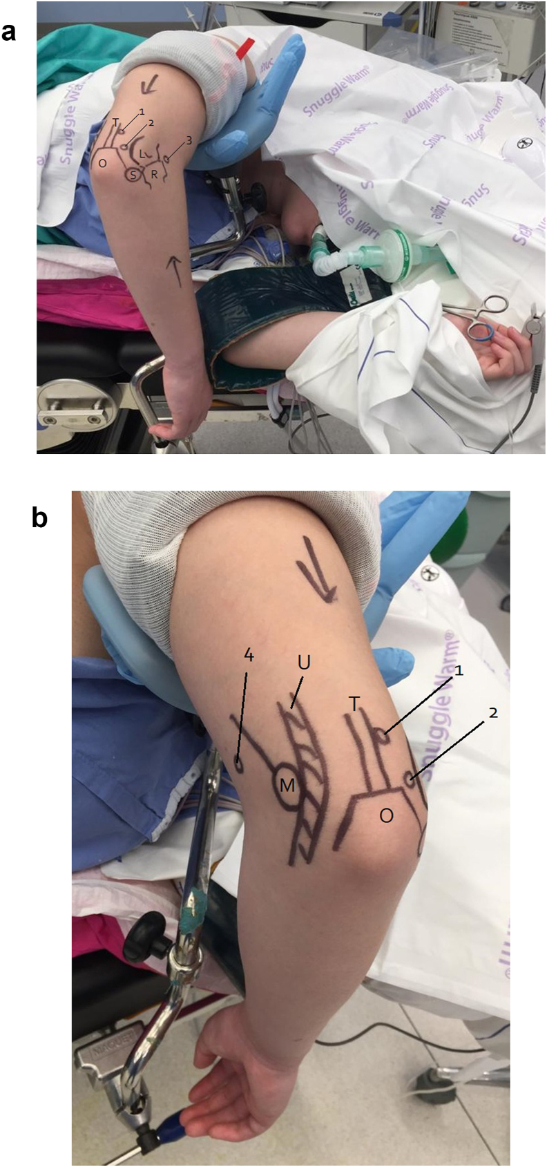 Fig. 4