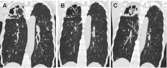 Fig 2