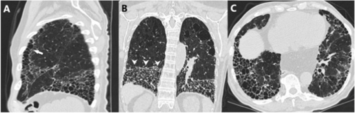 Fig. 2