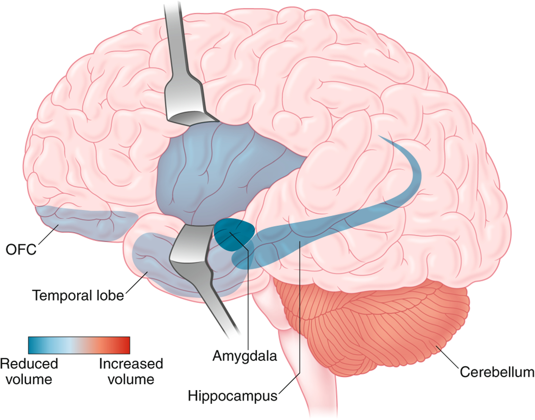 Fig. 3 |