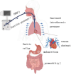 Diagram illustrating the effects of positive pressure ventilation on the body. Arrows indicate increased intrathoracic pressure from a ventilator, leading to gastric reflux, malnutrition, venous obstruction, and increased intestinal permeability.