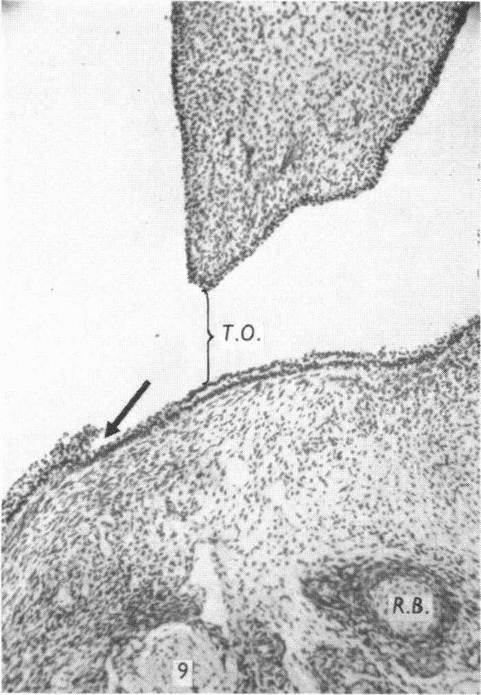 Fig. 9