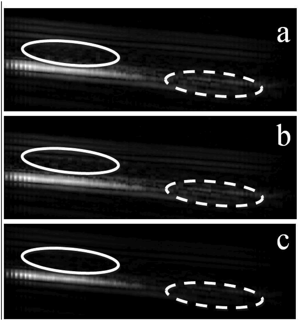 Fig. 10