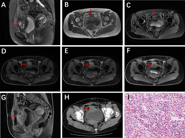 Figure 4