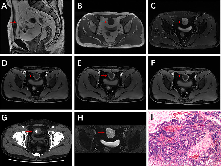 Figure 2