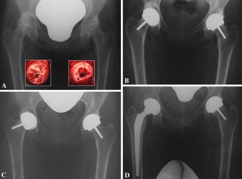 Fig. 2A–D