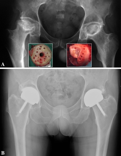 Fig. 1A–B