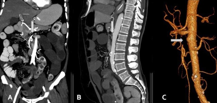 Fig. 4