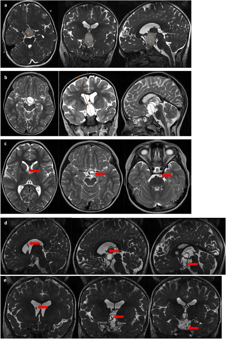 Figure 2