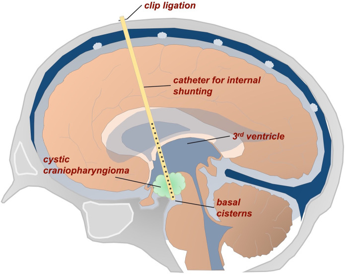 Figure 1