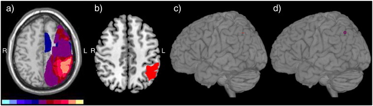 Fig. 1