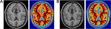 Fig. 79