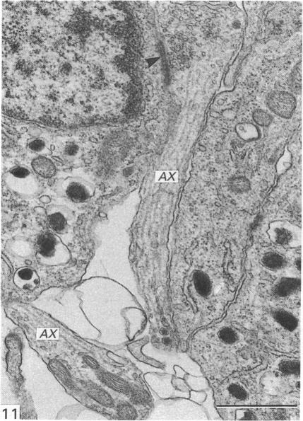 Fig. 11