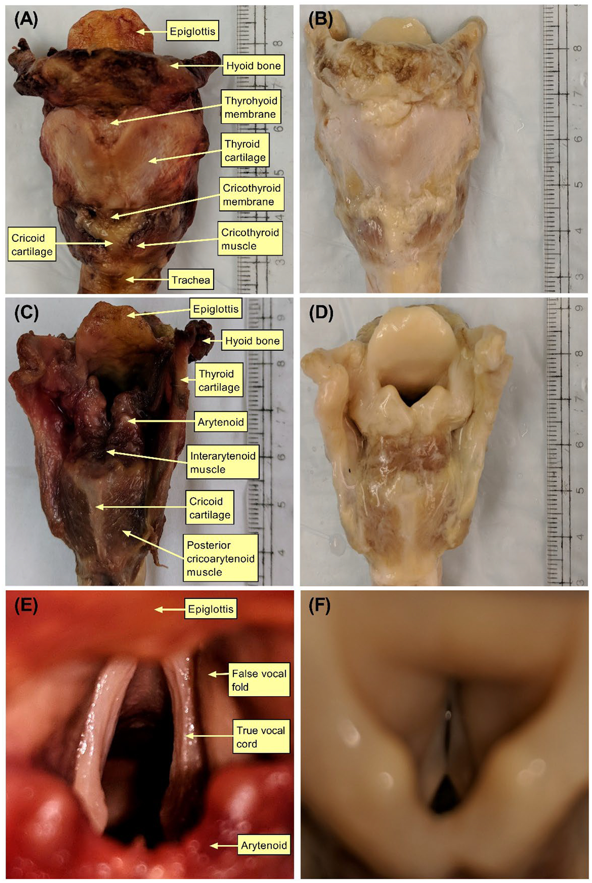 Figure 3: