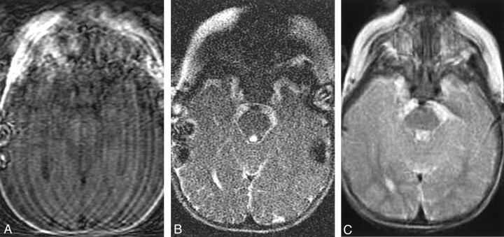 Fig 4.