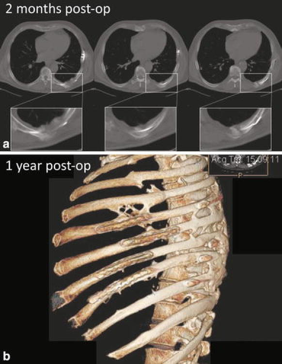 Fig. 4