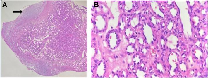 Fig 3