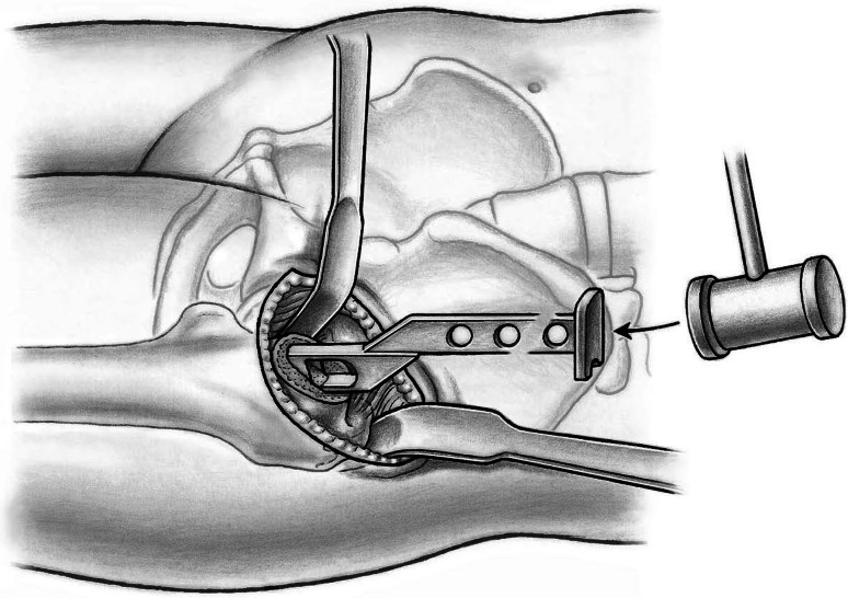 Fig. 12