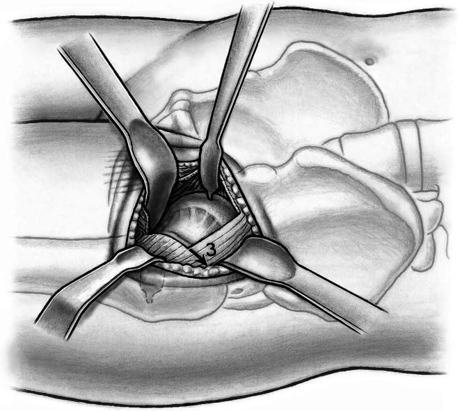 Fig. 7