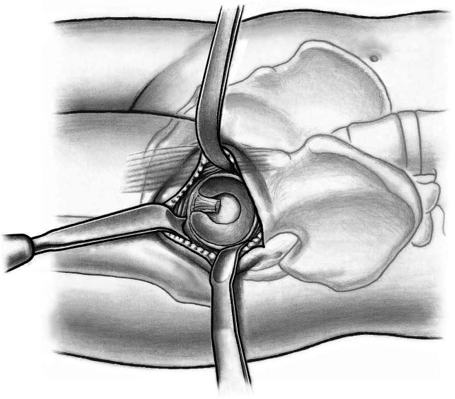 Fig. 13