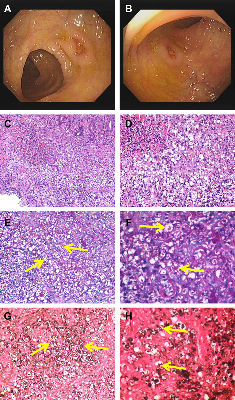 Figure 1