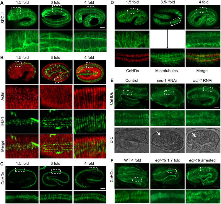 Fig. 1. The initialization of epidermal intracellular periodic patterns is actin and spectrin dependent. (A) SPC-1::GFP localization in the epidermis of embryos at early (1.5-fold), mid (3-fold) and late (4-fold) elongation stages. (B) Double-labeling of actin (red) and intermediate filaments (green) by ABD::mCherry and IFB-1::GFP in embryos at 1.5-fold, 3-fold and 4-fold elongation stages. (C) Epidermal distribution of CeHDs visualized by VAB-10A::GFP in embryos at 1.5-fold, 3-fold and 4-fold elongation stages. (D) Epidermal distribution of microtubules (green) labeled by anti-tubulin in embryos at 1.5-fold, 3.5-fold and 4-fold elongation stages. Double-labeling of microtubules and CeHDs (red, anti-VAB-10A) at the 3.5-fold embryonic stage is also shown (arrow). (E) Organization of CeHDs visualized by anti-VAB-10A in NR222 embryos with or without epidermal-specific RNAi against spc-1 and act-1. White arrows point to developed pharynx structures in late stage embryos. (F) Epidermal organization of CeHDs visualized by anti-VAB-10A in late stage wild-type (WT 4-fold), and early stage egl-19(n2368) mutant embryos before muscle defects occur (egl-19 1.7 fold), or late stage egl-19(n2368), which are arrested at 1.5-fold elongation (egl-19 arrested). Boxed areas in A–F are enlarged below. Scale bars: 5 μm.