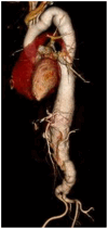 Fig 1