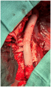 Fig 3